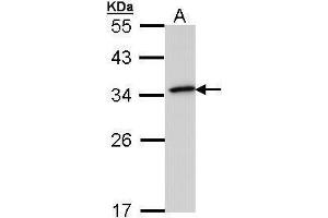 WB Image Sample (30 ug of whole cell lysate) A: 293T 12% SDS PAGE antibody diluted at 1:1000 (NQO1 anticorps  (Center))