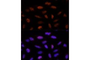 Immunofluorescence analysis of U-2 OS cells using ADNP Polyclonal Antibody (ABIN1678582, ABIN3019032, ABIN3019033 and ABIN6220678) at dilution of 1:100 (40x lens). (ADNP anticorps  (AA 843-1102))