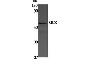 Western Blotting (WB) image for anti-Glucokinase (Hexokinase 4) (GCK) antibody (ABIN5961047) (GCK anticorps)