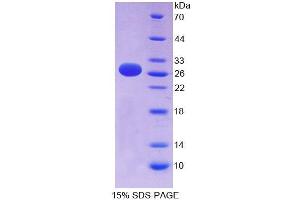 SDS-PAGE analysis of Human EFNA3 Protein. (Ephrin A3 Protein (EFNA3))