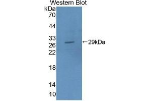 Detection of Recombinant FUS, Human using Polyclonal Antibody to Fusion (FUS) (Fusion (FUS) (AA 193-444) anticorps)