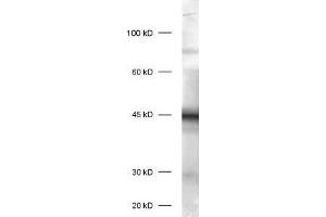 dilution: 1 : 1000, sample: brain homogenate of newborn rats (P1) (Doublecortin anticorps)