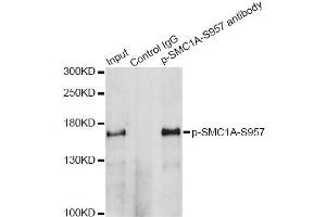 Immunoprecipitation analysis of 200 μg extracts of HeLa cells treated by UV using 2. (SMC1A anticorps  (pSer957))