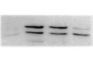 Western Blotting (WB) image for anti-Mitogen-Activated Protein Kinase 8 (MAPK8) antibody (ABIN126827) (JNK anticorps)