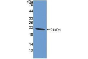 Detection of Recombinant AIF1, Human using Polyclonal Antibody to Ionized Calcium-binding Adapter Molecule 1 (IBA1) (Iba1 anticorps  (AA 1-147))