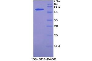 SDS-PAGE analysis of Mouse ACE Protein. (Angiotensin I Converting Enzyme 1 Protéine)