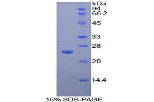 SDS-PAGE analysis of Mouse MST1R Protein. (MST1R Protéine)