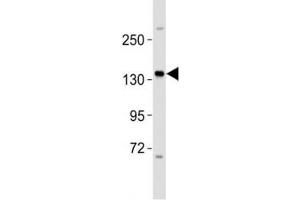 Western blot testing of ERBB4 antibody at 1:2000 dilution + MCF-7 lysate (ERBB4 anticorps  (AA 1141-1166))