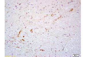 Formalin-fixed and paraffin embedded rat brain labeled with Anti- PROK2/Prokineticin 2 Polyclonal Antibody, Unconjugated  at 1:200 followed by conjugation to the secondary antibody and DAB staining (PROK2 anticorps  (AA 28-100))