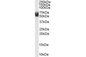 Western Blotting (WB) image for anti-F-Box and Leucine-Rich Repeat Protein 3 (FBXL3) (N-Term) antibody (ABIN2465686) (FBXL3 anticorps  (N-Term))