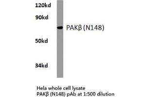 Western blot (WB) analysis of PAKβ antibody in extracts from hela cells. (PAK3 anticorps)