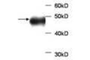 Image no. 1 for anti-Aldolase B, Fructose-Bisphosphate (ALDOB) antibody (ABIN791520) (ALDOB anticorps)