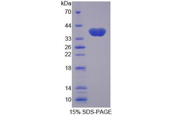 SLC25A11 Protéine