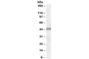 Western blot testing of human testis lysate with STK35 antibody at 1ug/ml. (STK35 anticorps)